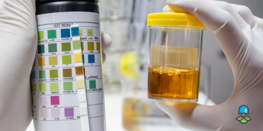 آیا ادرار قهوه ای در بارداری خطرناک است؟